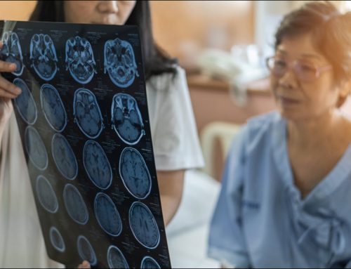 Stroke Rehabilitation: Restoring Movement and Function