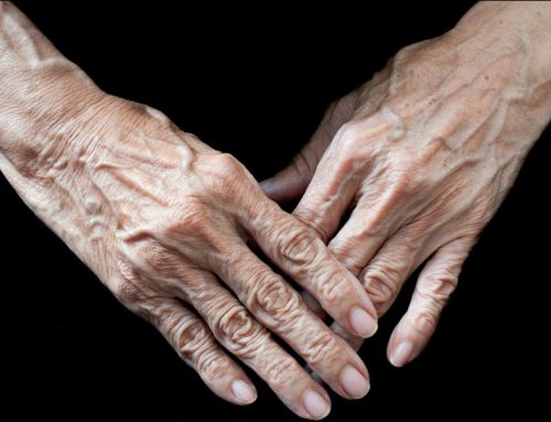 Reduce the Impact of Arthritis and Maintain Independence
